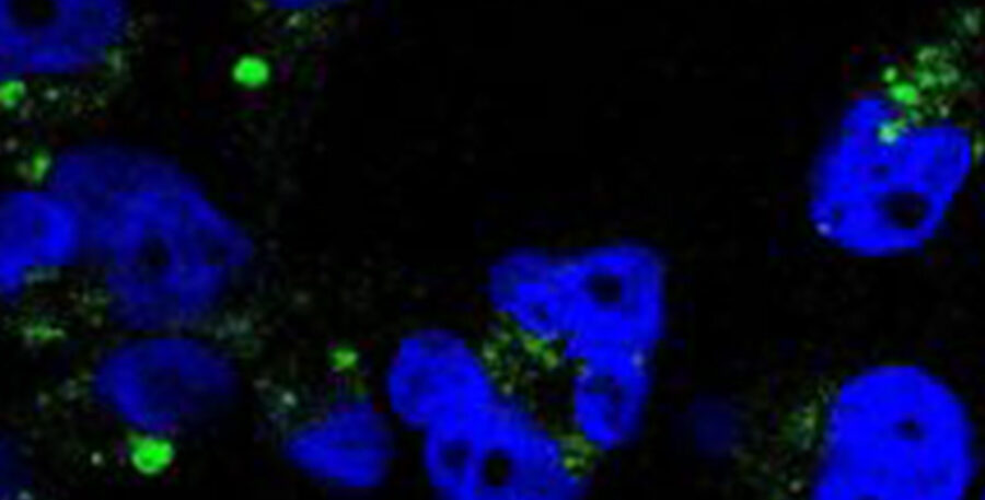 microscopic view of bioluminescent cells