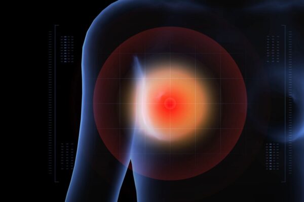image of target on breast