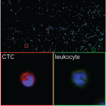 Captured circulating tumor cells