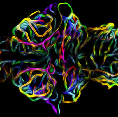 Colorful image of capillaries in the zebrafish brain (image by Michael Taylor)